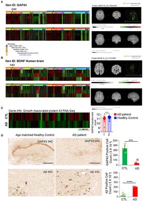 GAP-43 closely interacts with BDNF in hippocampal neurons and is associated with Alzheimer's disease progression